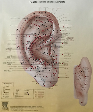 Ohrakupunktur-Punkte